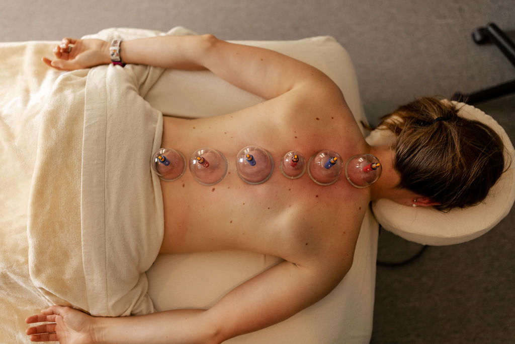 Book a cupping massage therapy appointment in Brookfield, WI Cupping Therapy at MEND Studios